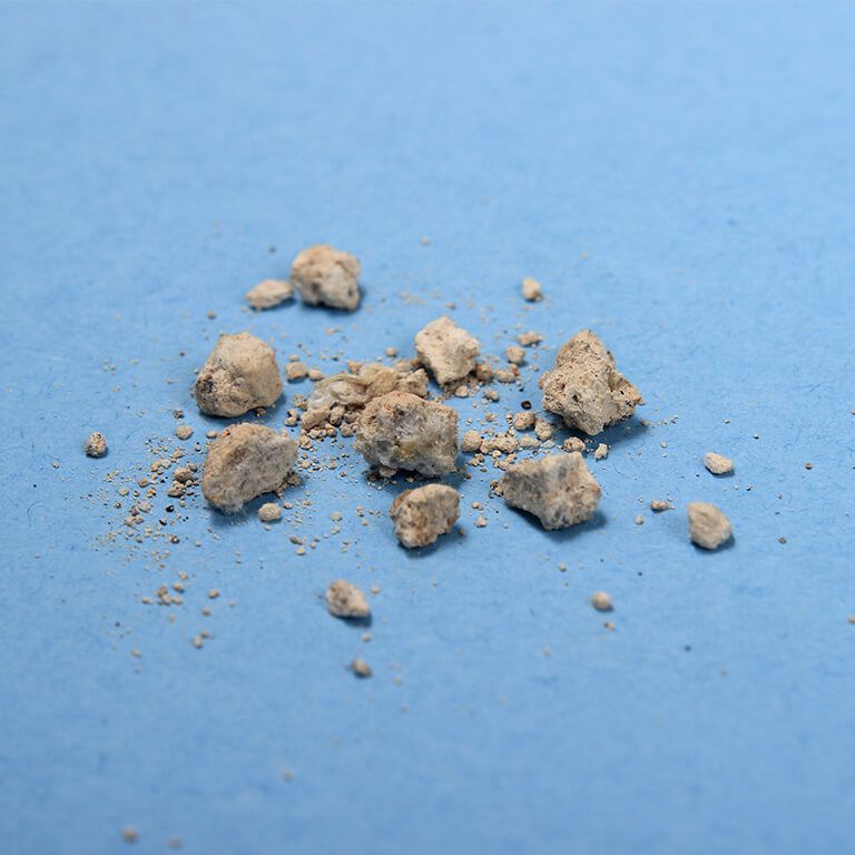 Nierengrieß liegt auf blauem Grund: Die Kristalle im Urin sind meist sehr klein. 